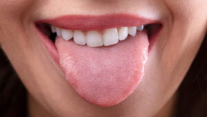 AI Algorithm Achieves 98% Accuracy in Disease Diagnosis Through Tongue Color Analysis